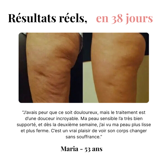 Orozo – Masseur Raffermissant Anti-Cellulite | Draine, Tonifie, Lisse
