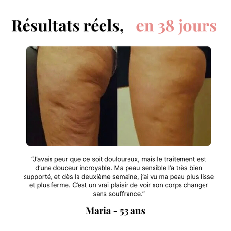 Orozo – Masseur Raffermissant Anti-Cellulite | Draine, Tonifie, Lisse
