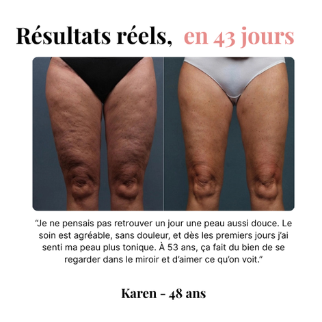 Orozo – Masseur Raffermissant Anti-Cellulite | Draine, Tonifie, Lisse