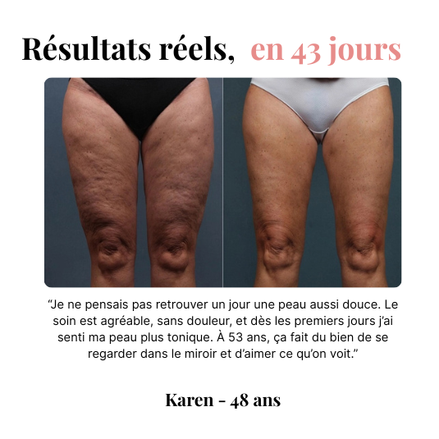 Orozo – Masseur Raffermissant Anti-Cellulite | Draine, Tonifie, Lisse