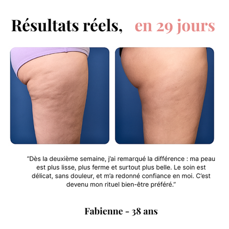 Orozo – Masseur Raffermissant Anti-Cellulite | Draine, Tonifie, Lisse