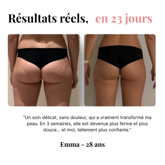 Orozo – Masseur Raffermissant Anti-Cellulite | Draine, Tonifie, Lisse